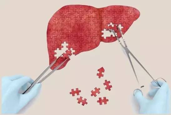 拯救不良肝臟，補充硒元素，真正預防肝病風險